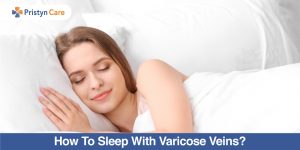 How-To-Sleep-With-Varicose-Veins