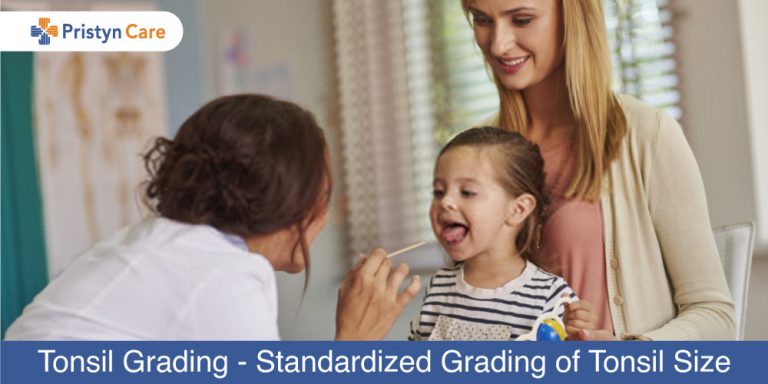 Tonsil-Grading---Standardized-Grading-of-Tonsil-Size