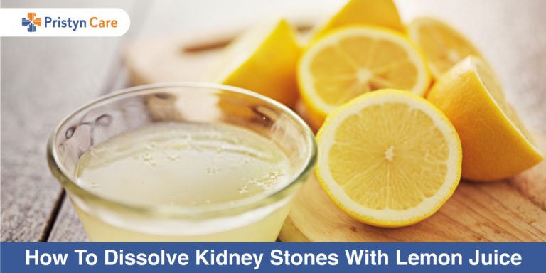 dissolve kidney stones with lemon juice