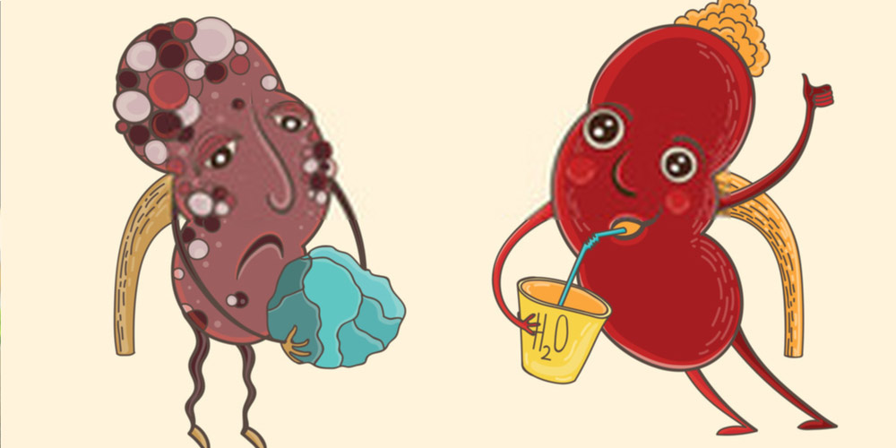 healthy kidney-drink water for kidney stones