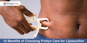 10-Benefits-of-Choosing-Pristyn-Care-for-Liposuction
