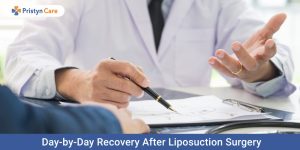 Day-by-day-recovery-after-liposuction