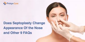 Does-Septoplasty-Change-Appearance-Of-the-Nose-and-Other-9-FAQs