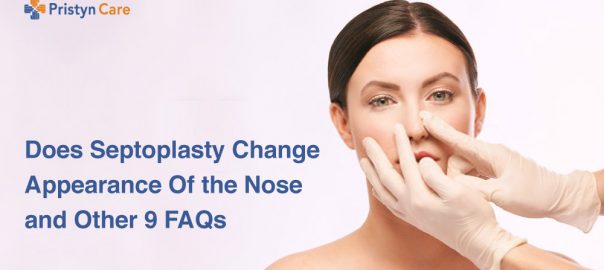 Does Septoplasty Change Appearance Of the Nose and Other 9 FAQs