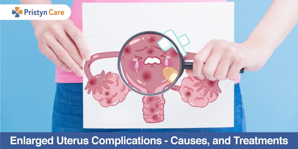 Uterine Fibroids After Menopause - Pristyn Care