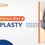 I Took The Decision To Get My Nose Surgery Done