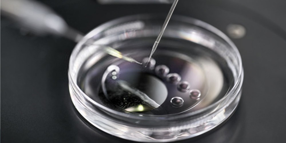 IVF-Treatment-And-Its-Success-Rate-In-India-2