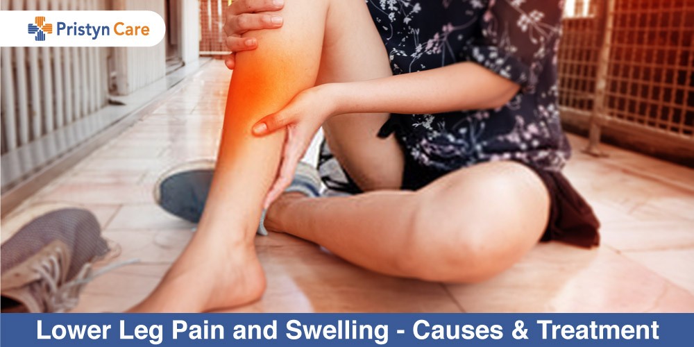 Lower-Leg-Pain-and-Swelling-Causes-and-Treatment