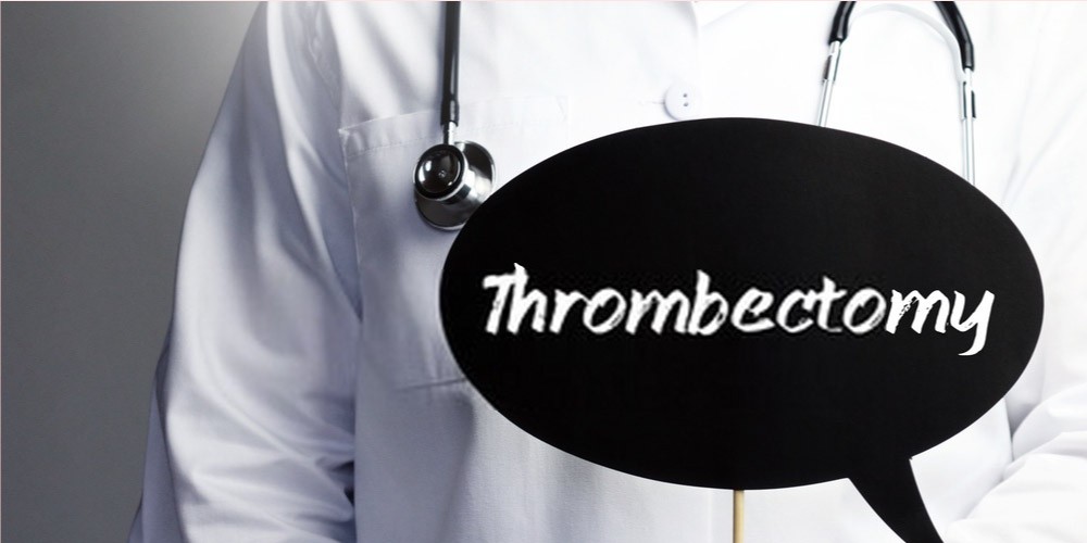 thrombectomy to treat DVT