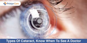 types-of-cataract-know-when-to-see-a-doctor-pc0578