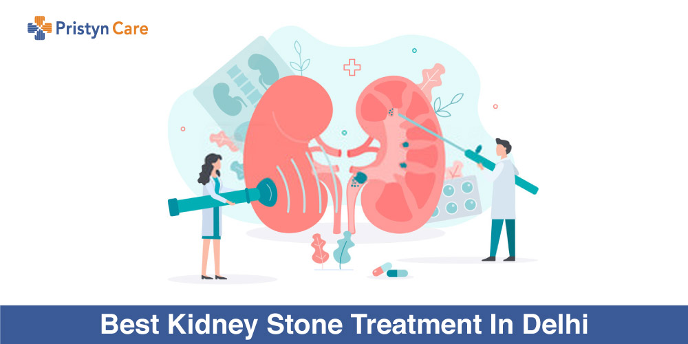 Best-Kidney-Stone-Treatment-In-Delhi