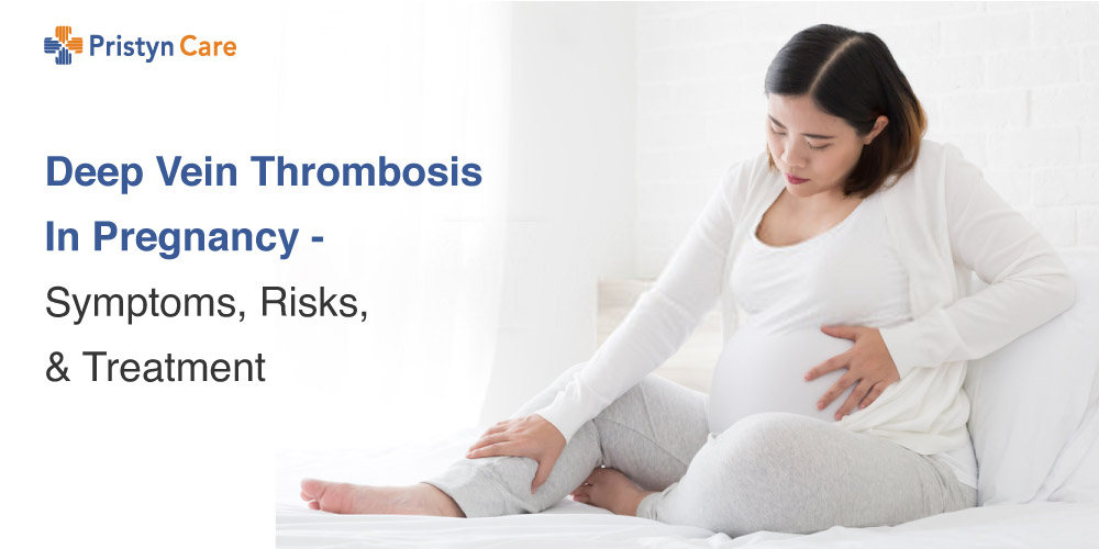 Deep-Vein-Thrombosis-In-Pregnancy-symptoms,-Risks,-and-Treatment