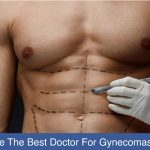 How-To-Choose-The-Best-Doctor-For-Gynecomastia-Treatment