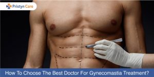 How-To-Choose-The-Best-Doctor-For-Gynecomastia-Treatment