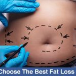 How-To-Choose-The-Best-Fat-Loss-Doctor