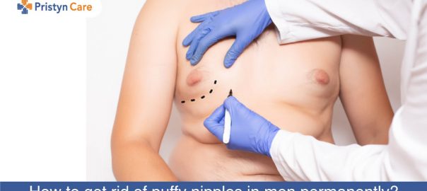 How To Get Rid Of Puffy Nipples In Men Permanently?