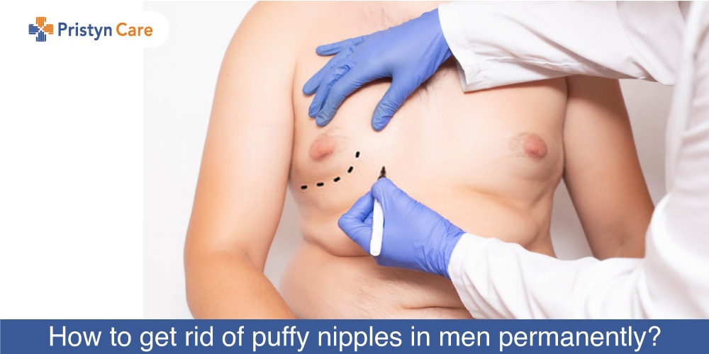 How To Get Rid Of Puffy Nipples In Men Permanently? - Pristyn Care