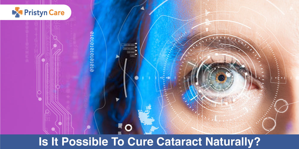 can-you-get-rid-of-cataract-naturally