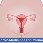 homeopathic treatment for uterine fibroids
