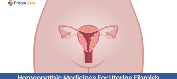Homeopathic Medicines for Uterine Fibroids