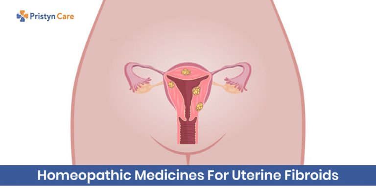 homeopathic treatment for uterine fibroids
