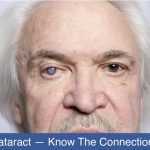 diabetes-and-cataract-know-the-connection-and-treatment