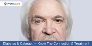 diabetes-and-cataract-know-the-connection-and-treatment
