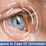 what-happens-in-case-of-untreated-cataract