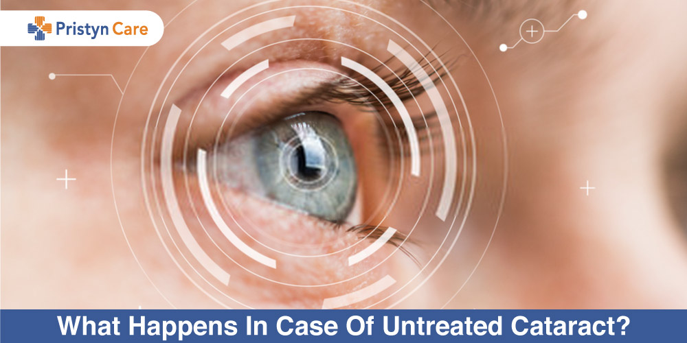what-happens-in-case-of-untreated-cataract