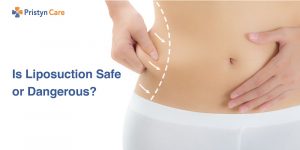 Is liposuction safe or dangerous?