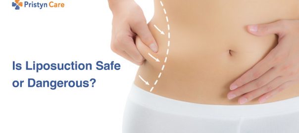 Is Liposuction Safe or Dangerous?