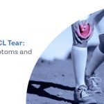 Grades of ACL Tear: Causes, Symptoms and Treatment