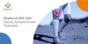 Grades of ACL Tear: Causes, Symptoms and Treatment