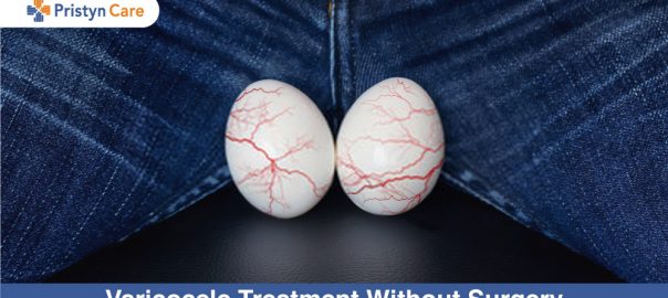 Treatment Of Varicocele Without Surgery
