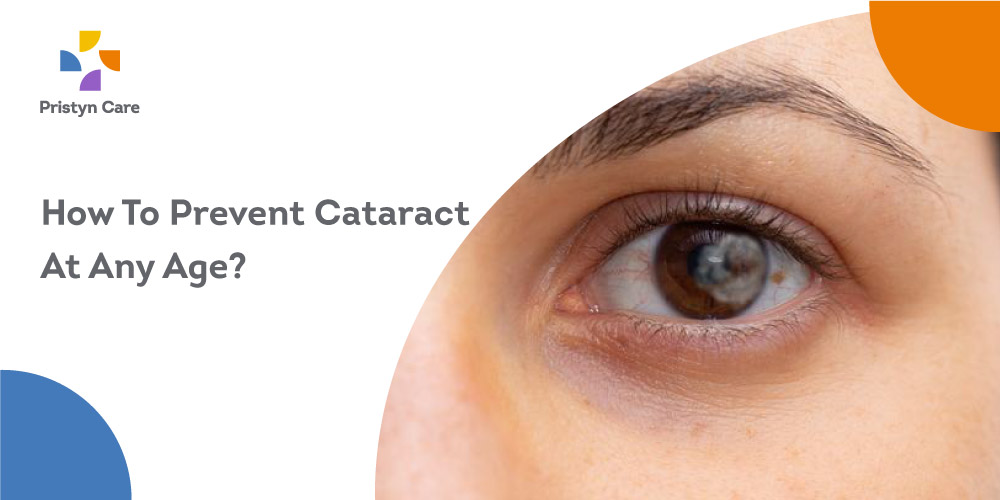 How-To-Prevent-Cataract-At-Any-Age