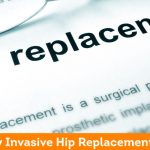 Minimally Invasive Hip Replacement Surgery