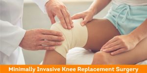 Minimally Invasive Knee Replacement Surgery