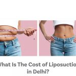 What-Is-The-Cost-of-Liposuction-in-Delhi