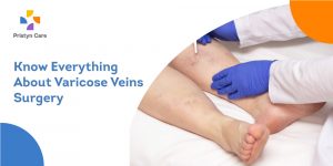 Know-Everything-About-Varicose-Veins-Surgery