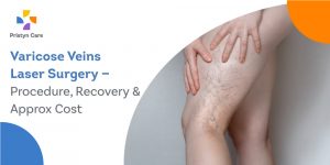 varicose-veins-laser-surgery-procedure-recovery-approx-cost