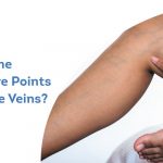 what-are-the-acupressure-points-for-varicose-veins