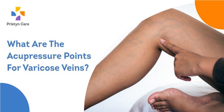 what-are-the-acupressure-points-for-varicose-veins