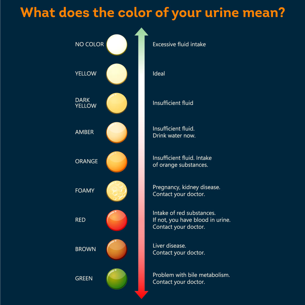 What Causes Dark Urine? Pristine care Jioforme