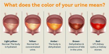 urine color