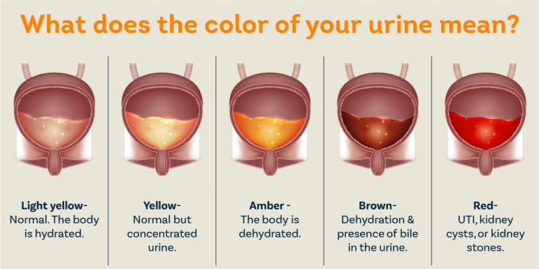 What Causes Blood In Urine Pristyn Care