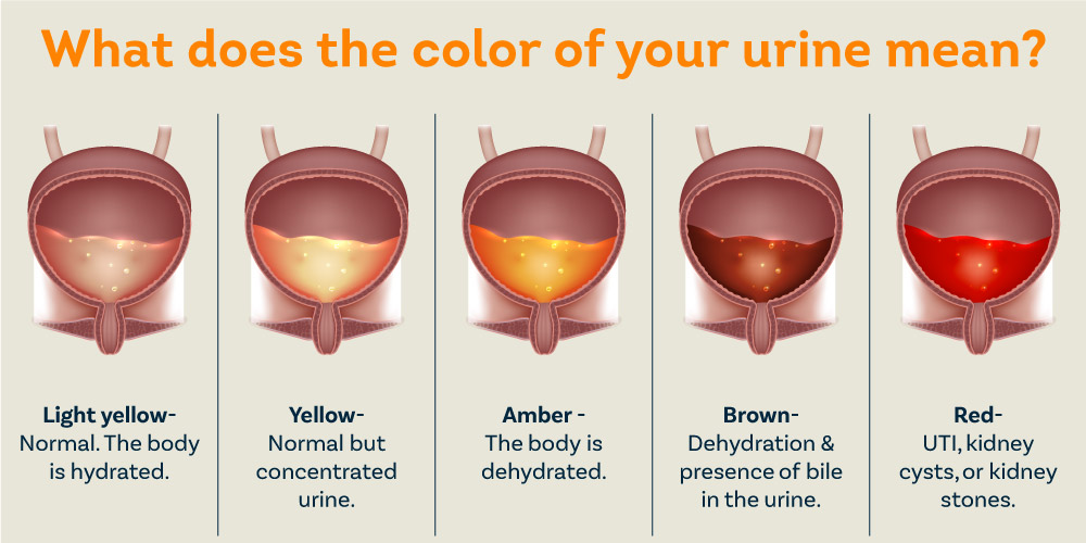 Blood in urine female