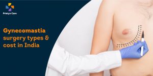 Gynecomastia surgery types & cost in India