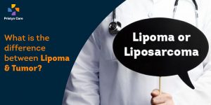 difference-between-lipoma-and-tumor