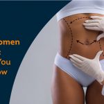 female-abdomen-liposuction