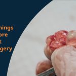 Things to know about ovarian cyst removal surgery